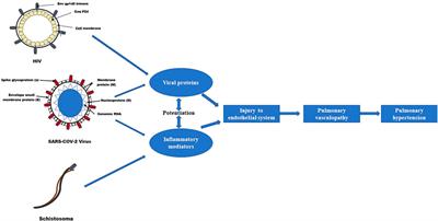 From acute SARS-CoV-2 infection to pulmonary hypertension